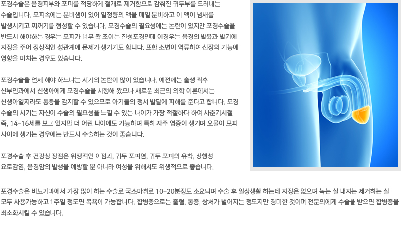포경수술이란