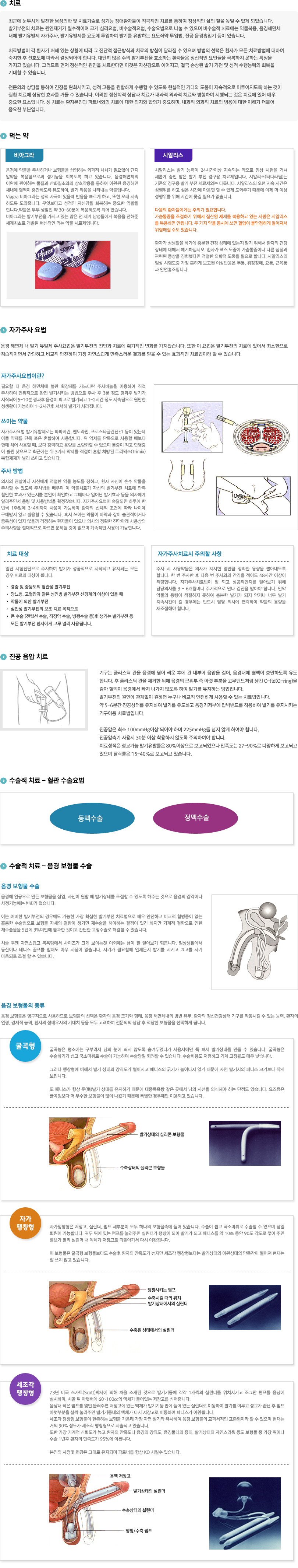 발기부전치료