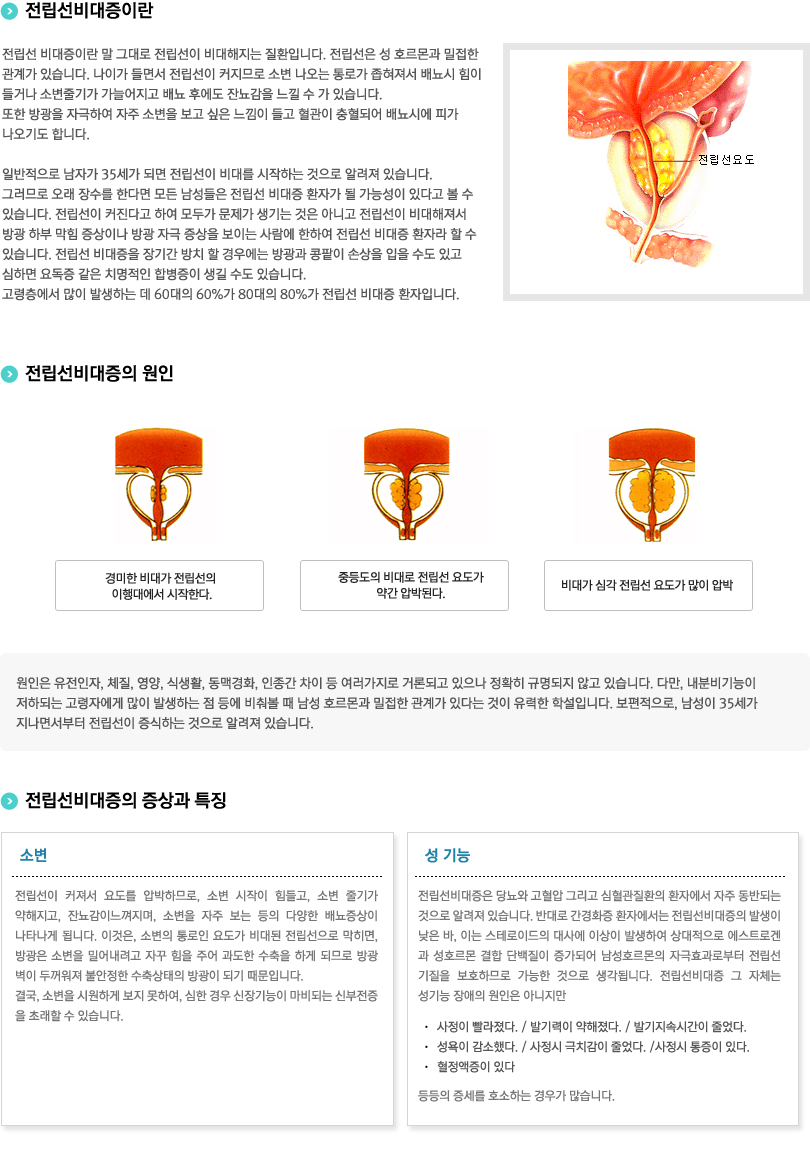 전립선비대증이란