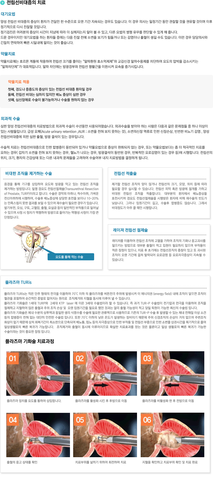 전립선비대증의 치료
