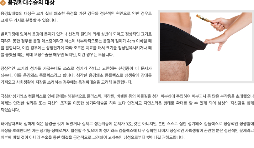 음경확대술의 대상