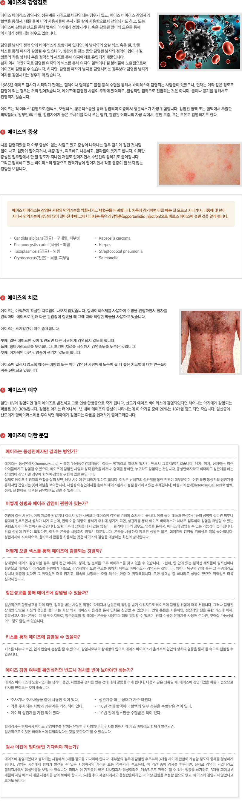 에이즈