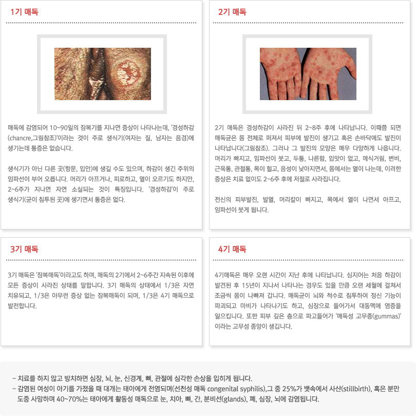 매독